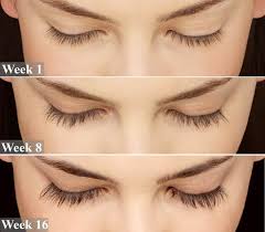I instruct my patients to place 1 drop of latisse directly onto a very tiny. Latisse Eyelash Treatment Patel Plastic Surgery Bck Patel Md