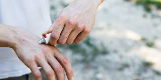 Image result for Anthralin