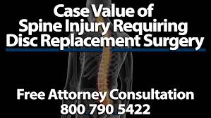 Include the date and time for every piece of information you add to your. Average Settlement Case Value Car Accident Disc Replacement