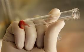 Israeli Scientists See Breakthrough In Aids Cure The Times Of Israel