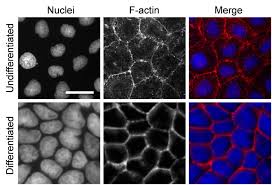 Caco-2BBe cells cultured on polycarbonate membranes. Cells cultured 1... |  Download Scientific Diagram