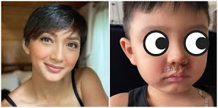 Iya Villania Cautions Parents About Cellulitis