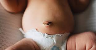 Newborn tips and tricks by ela wunderli of itsy photography, pediat. The Umbilical Cord Fell Off What Should I Do