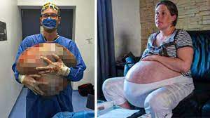 This south african woman literally pregnant with 10 babies at the same time. What S The Longest A Woman Has Been Pregnant