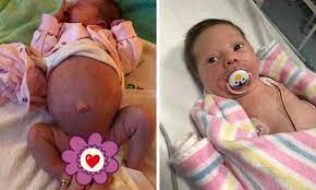 Distended Stomach In Children How I Knew Something Was Wrong Kidspot