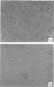 Basic structural unit of all organisms: Vero Cell Response To Tf A Normal Vero Cells B Vero Cells Exposed To Download Scientific Diagram