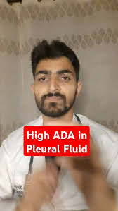 High ADA levels in Pleural fluid, TERM-BQL, 1.Tuberculosis, 2.Empyema,  3.Rheumatoid pleuritis, 4.Malignancy, 5.Brucellosis , 6.Q fever,  7.Lymphoma, #InfectiousDiseases, #Pulmonology, ...