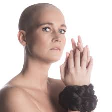 Deze vrouwen laten trots hun 'imperfecties' zien aan fotograaf Rob