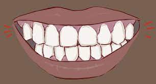 You may be wondering how to strengthen enamel. 3 Ways To Treat Weak Tooth Enamel Wikihow