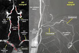 kol damari tikanikliklari
