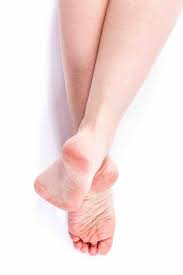 8 Remedes Simples Pour Les Pieds Secs Et Les Talons Fendilles