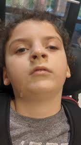 Have a look at Mary-Kate's YouTube video she has made all about her life  with Dsypraxia ! well done Mary-Kate!