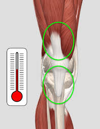 There are four muscles in the anterior compartment of the leg. Fixing Patellar Quad Tendon Pain Squat University