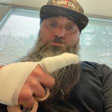 I did the dumbest thing yesterday!!! Never mess with your band saw  components while running the saw!! My finger went for a ride around the  blade and pulley! Broken tip of my