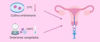 Cuanto Tiempo Tarda El Embrion En Implantarse En El Utero Cuanto Tarda Linear Unit Implantarse El Origen Luego De Solfa Syllable Transferencia