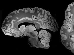 For example, the cost of a ct scanner can be as low as $65,000 for a refurbished one that produces only small images quickly. Home Of The 299 Mri