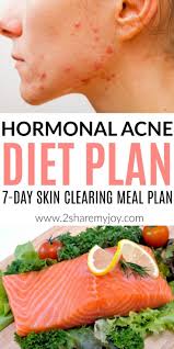 Pin On Pcos Acne