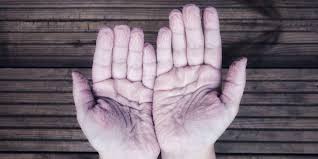 Kalau takut berhadapan dengan penderitaan , lebih. Alasan Ilmiah Tangan Keriput Jika Terlalu Lama Terkena Air