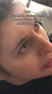 Día 5 Después del Trasplante Capilar: Progreso Visible