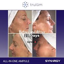 Adsbygoogle Window Adsbygoogle Push Jual Obat Jerawat Paling Ampuh Dan Cepat Trulum Skincare Synergy Di Malaka Jaya Obat Jerawat Jerawat Komedo