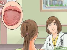 How To Get Rid Of Bumps On Your Tongue Bumps On Tongue Tongue Bump