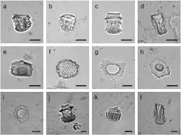 Image result for Stanfieldiella imperforata