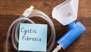 Cystic fibrosis affects the cells that produce mucus, sweat and digestive juices. Cystic Fibrosis Johns Hopkins Medicine