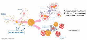 Patients and families that would value the chance to take a chance on the. Fda Committee To Rule On Experimental Alzheimer S Drug That Could Slow Disease Slashgear
