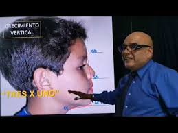 CLASIFICACIÓN CLINICA DE LAS MALOCLUSIONES VERTICALES DE JULIO PUMA 2