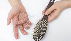 أهم أسباب تساقط الشعر للرجال والنساء وهل تنفع عملية زراعة الشعر Hair Loss Remedies Postpartum Hair Loss Hair Loss Causes