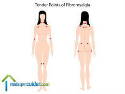 Quem tem fibromialgia pode fazer exercícios? Fibromialgia O Que E Sintomas Tratamentos E Causas Guia Completo
