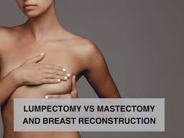 Image result for Mastectomy