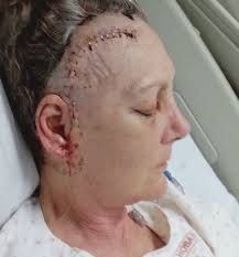 18 years of abuse left Deborah with complex trauma.