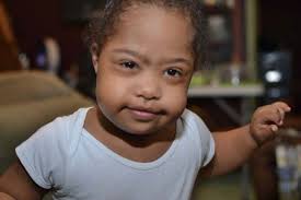 How To Deliver A Diagnosis Of Down Syndrome: An Open Letter To OB/GYNs