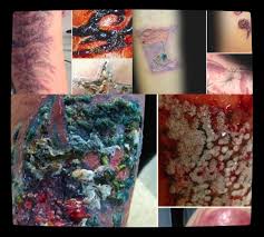Lin, contracting an infection isn't an uncommon scenario. Tattoo Infections Bloodborne Pathogens Essential Info For Tattoo Artists Bloodborne Pathogens Training