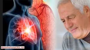 That fair workers' compensation is provided to all victims of asbestos diseases. How Can Mesothelioma Be Treated Telegraph