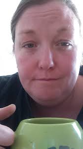 Should I still be in pain after D&C and IUD insertion with endometriosis?