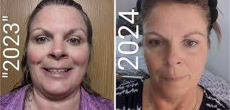 CRAYFISH: LEARN THE HEALTH BENEFITS Growing up, my grandma had a simple  rule “No crayfish, no soup” No seen anyone who loved crayfish more than  her😄 I thought she was just being