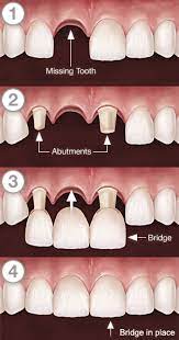 Pin On Dental Assistant