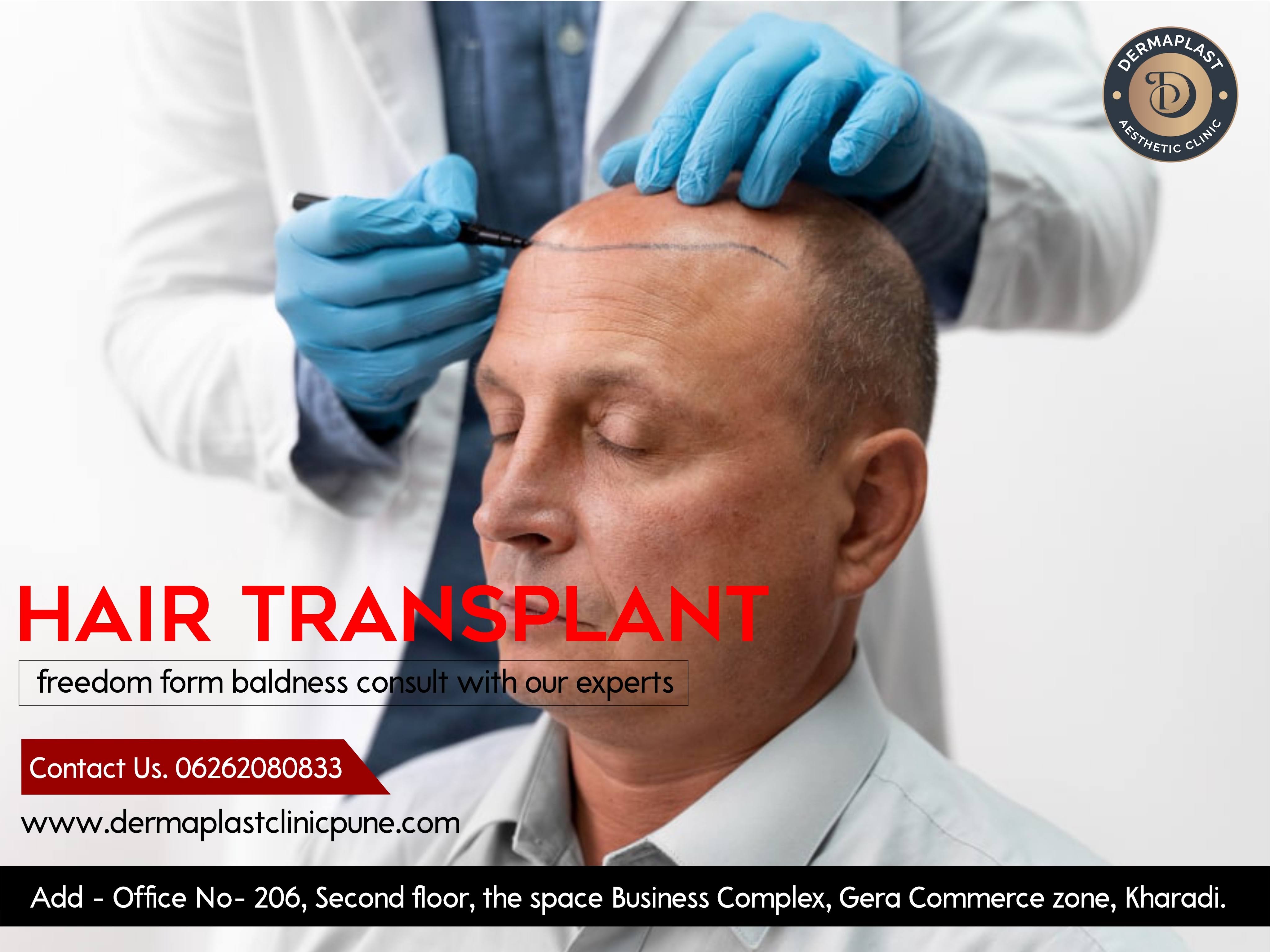 Hair Transplant product image