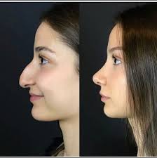 From becky to stacy with one rhino