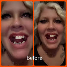 Bionic Smile Fan Club