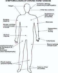 Pin By Stevie Thomas On Nrs 340 Tutoring Kidney Disease Chronic Kidney Disease Chronic Kidney Failure