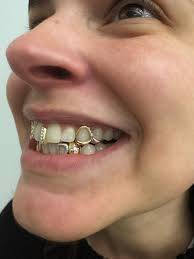 have u ever seen such an icon?! @taraxlarke stylin' a @tegans.tooth.gems  white gold barbed wire piece + chandyyyy pixie dust fairie fang + excellent  hat that i wish was also my work