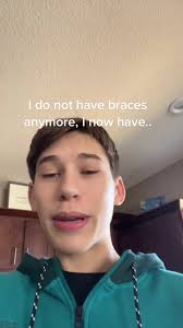 Who got crooked teeth now?? Idk but not me #teeth #braces #fyp