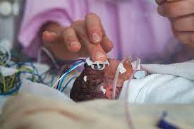 My 15 month old was born three weeks early and she has been hitting all her milestones early. Survival Of The Littlest The Long Term Impacts Of Being Born Extremely Early