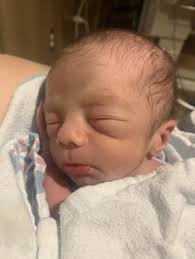 that kids gonna have a badass scar : r/pics