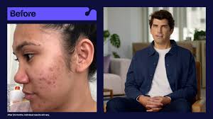 OUR STORY — KERSTYE KAU