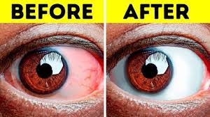 10+ Easy Exercises To Relieve Tired Eyes - Youtube
