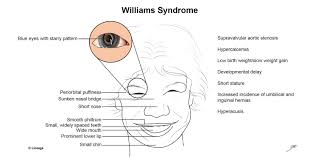 The nasal opening is the aperture at the front center of the skull below the eye orbits, below the bridge and above the spine and lower border. Chromosomal Diseases Biochemistry Medbullets Step 1